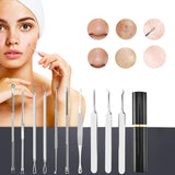 10 Pcs Black Head Remover Pimple Popper Tool Kit Silver
