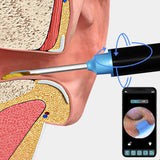 WiFi Visual Ear Wax Removal with Camera Ear Cleaner Tool Set Black