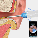 WiFi Visual Ear Wax Removal with Camera Ear Cleaner Tool Set White