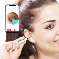 Wireless WiFi Ear Wax Remover with Otoscope Earwax Removal Tool Kit For Adult Kids White
