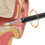 Ear Cleaner Ear Wax Cleaner Ear Camera Otoscope with Light Cleaner Removal Kit Black