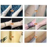 6Pcs Tattoo Scar Acne Cover Birthmark Cover Up Sticker Water Resistant Invisible Hide Tape