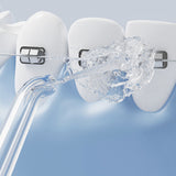 Portable Cordless Water Flosser for Deep Cleaning Braces & Gum Care