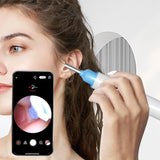 WiFi Visual Ear Wax Removal with Camera Ear Cleaner Tool Set White