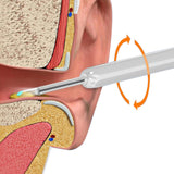 Ear Cleaner Ear Wax Cleaner Ear Camera Otoscope with Light Cleaner Removal Kit White