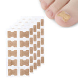 50PCS Toenail Ingrown Correction Stickers for Foot Care and Nail Alignment