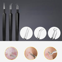 10 Pcs Black Head Remover Pimple Popper Tool Kit Black