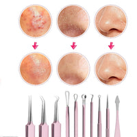 10 Pcs Black Head Remover Pimple Popper Tool Kit Pink