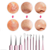 10 Pcs Black Head Remover Pimple Popper Tool Kit Pink