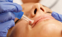 4 Pcs Facial and Body Cupping Therapy Set